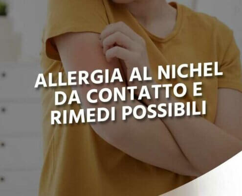 allergie al nichel la bottega del cazolaio