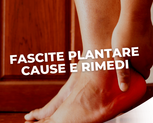 FASCITE PLANTARE