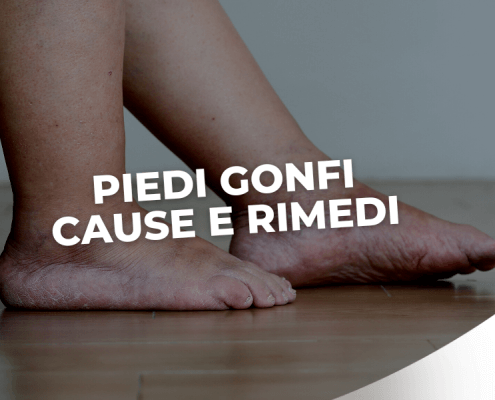 PIEDI GONFI