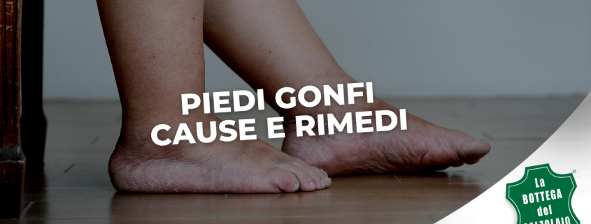 PIEDI GONFI